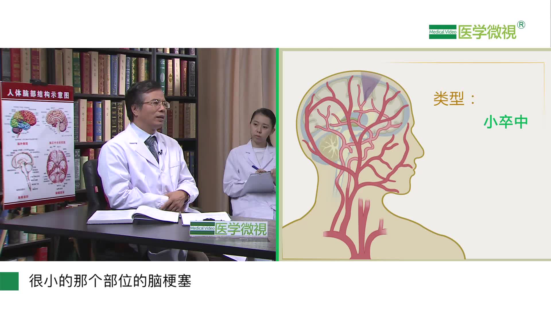 脑梗塞都有哪些类型？