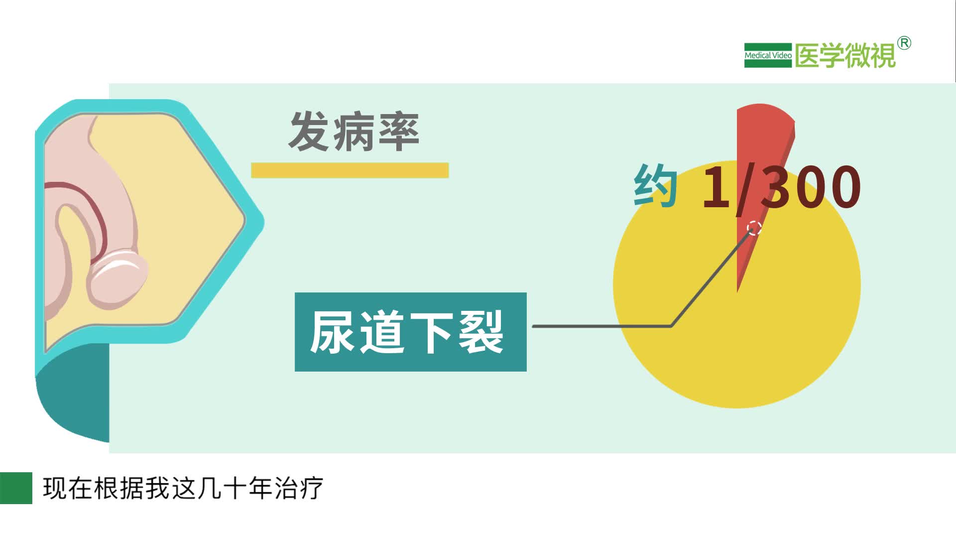 尿道下裂和尿道上裂如何区分