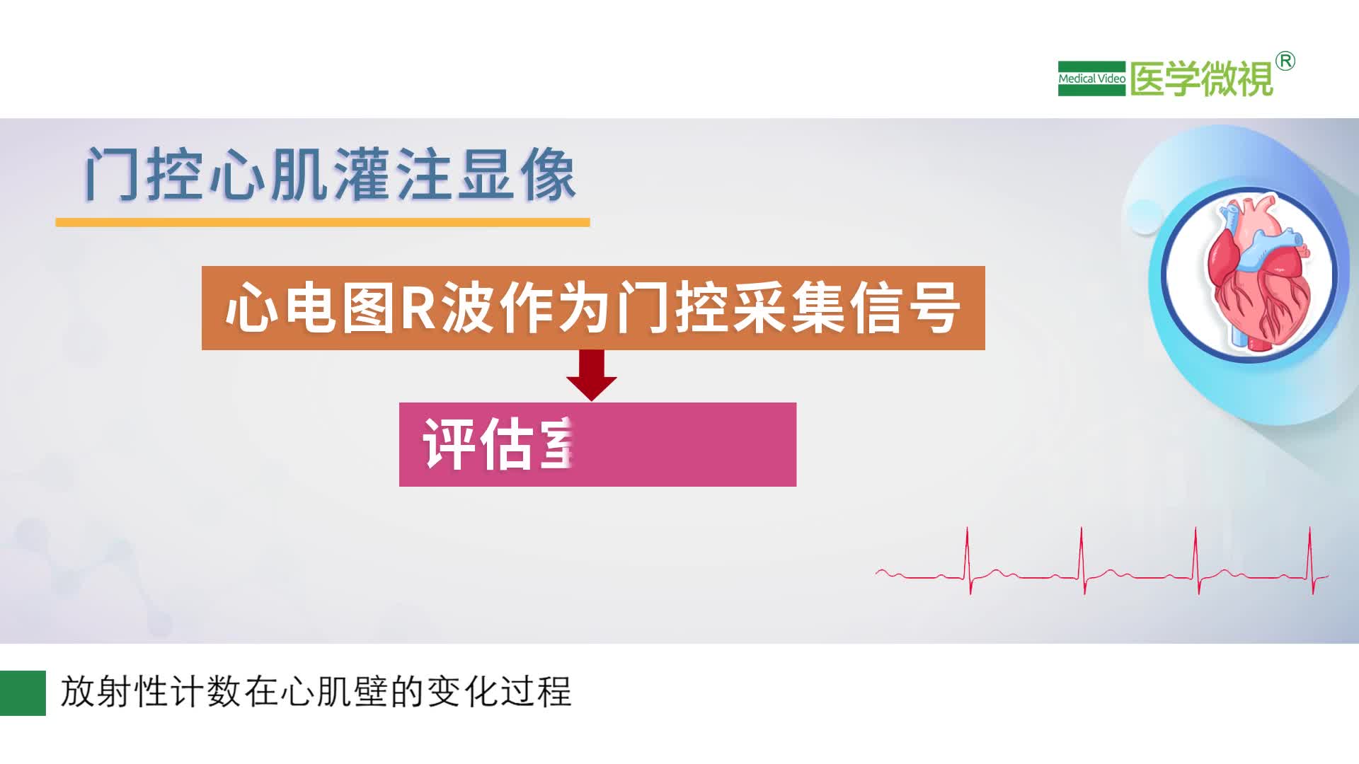 门控心肌灌注显像对诊断心肌缺血有什么作用心律不齐的患者能做吗
