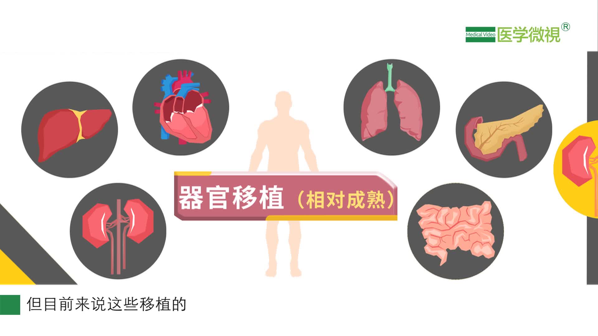 臨床上哪些人體器官移植術相對成熟