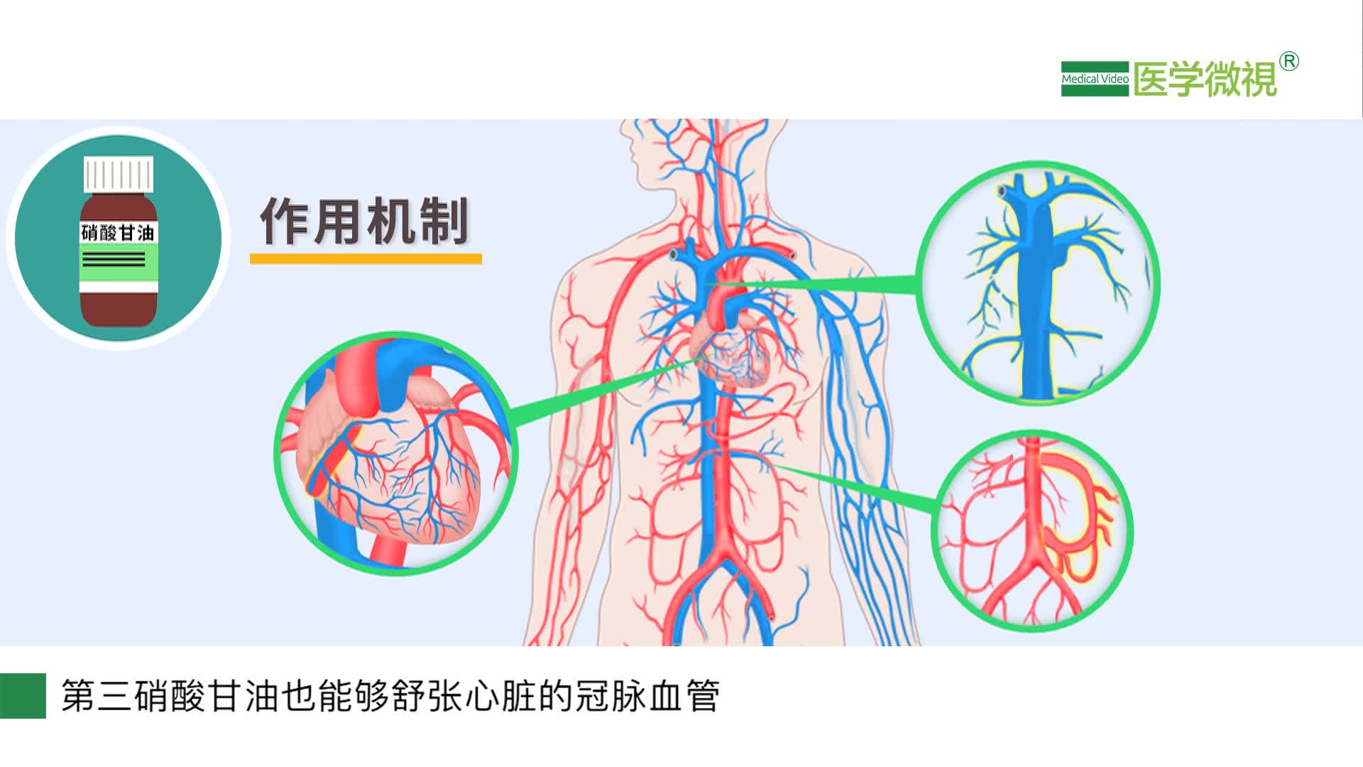 硝酸甘油片是怎么迅速治疗心绞痛的？硝酸甘油是什么？