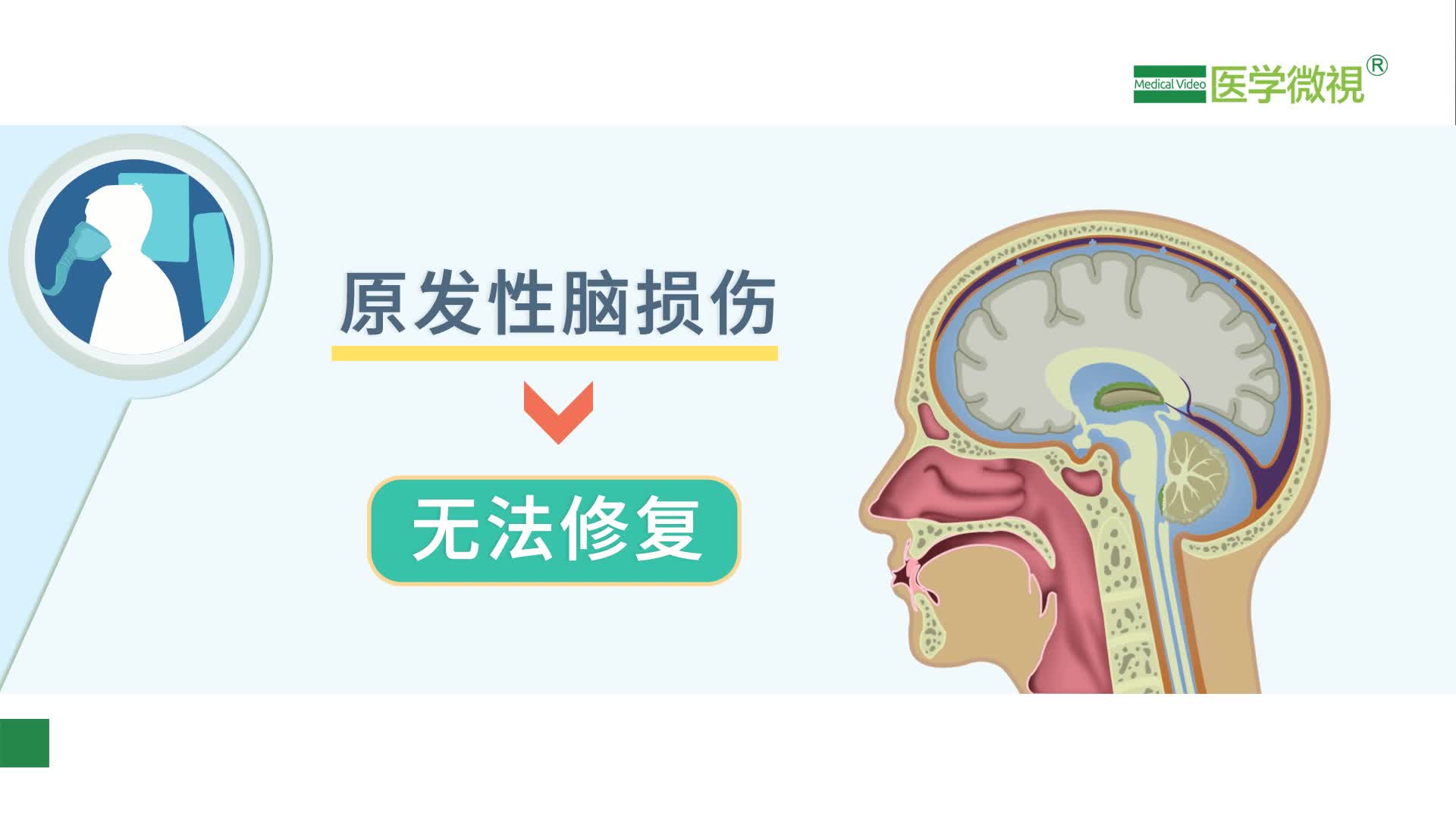 高壓氧治療顱腦損傷的原理是什麼