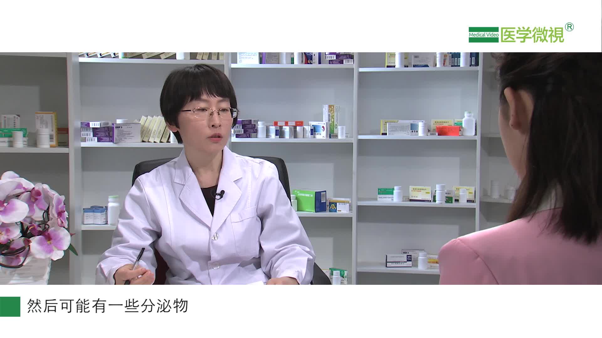 米诺环素也可以用来治疗痤疮吗？会变黑吗？