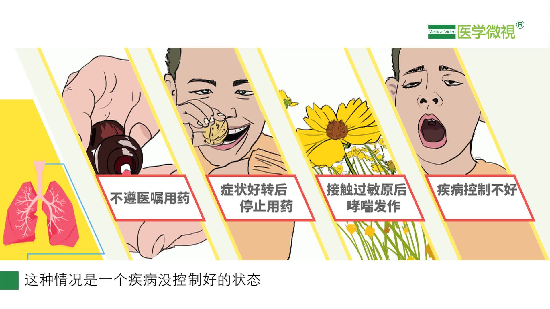 沙美特羅丙酸氟替卡松干粉吸入劑：長期使用會產(chǎn)生依賴性嗎？能長期使用嗎？