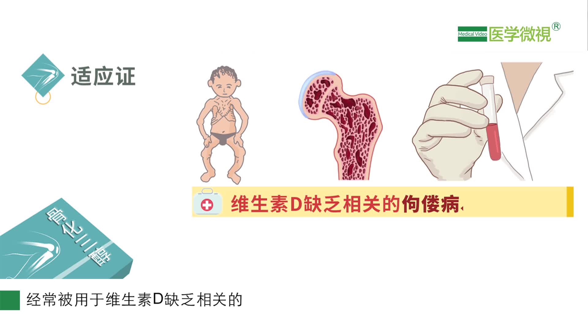 骨化三醇是一种什么药？能治疗哪些疾病？多少钱一盒？
