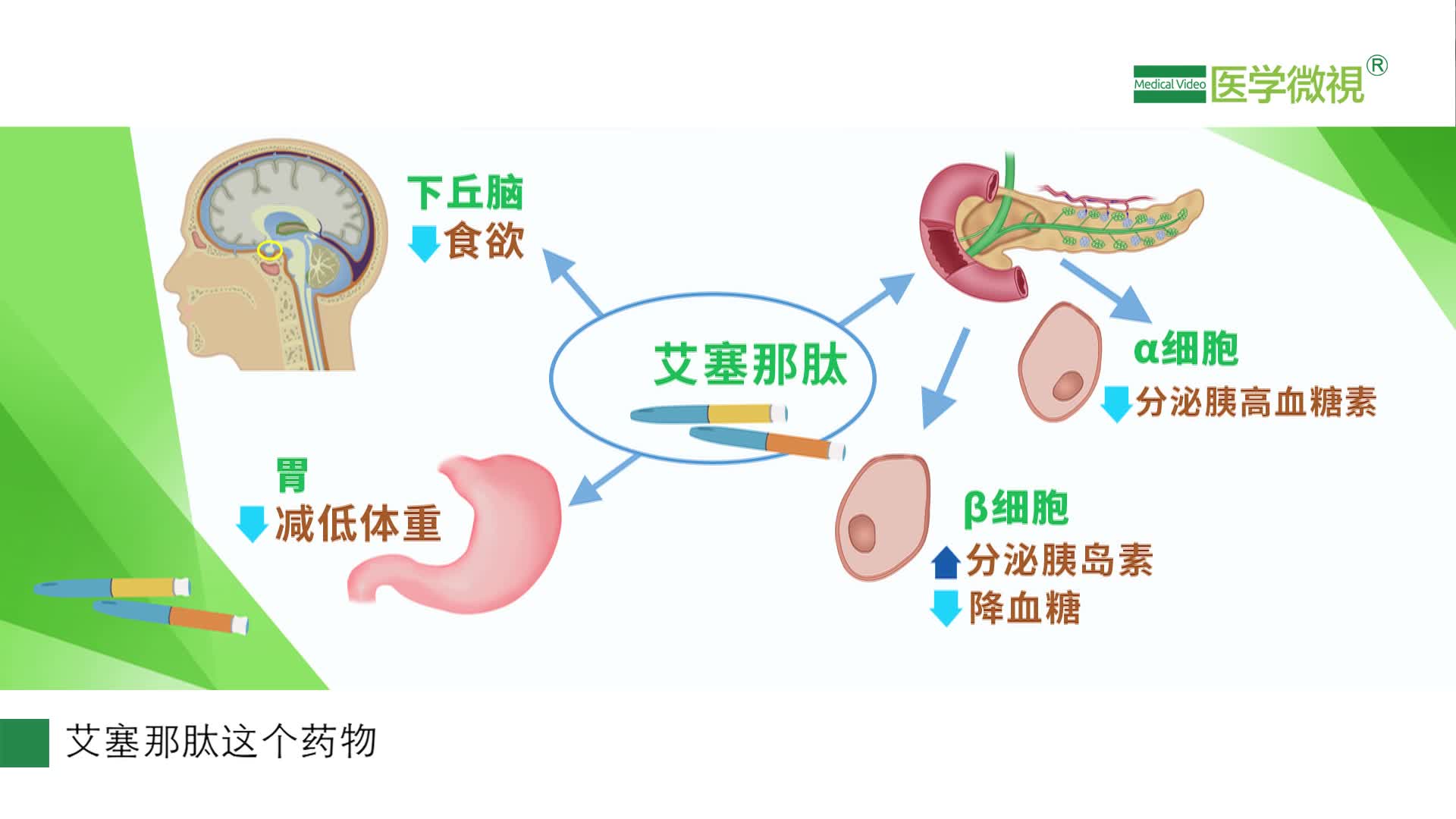 艾塞那肽在人体内是如何发挥降血糖作用的？减肥的副作用？  和胰岛素哪个好